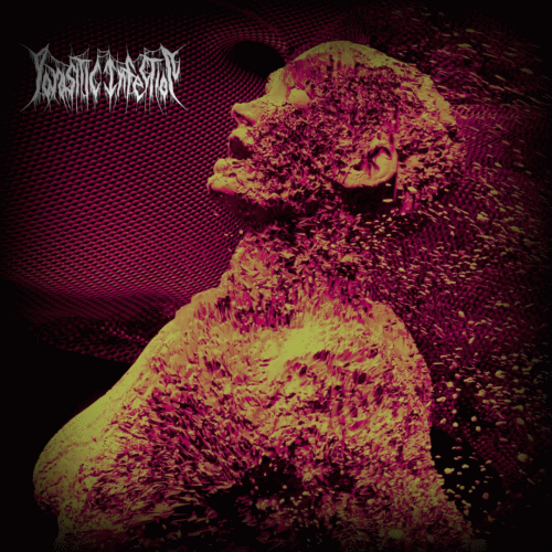 Parasitic Infection : Vertigo